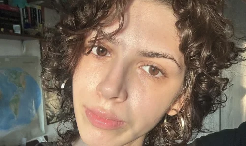 21-годишна девойка от Русе търси спасение в Германия: Инфекция след лечение на рак заплашва крака ѝ